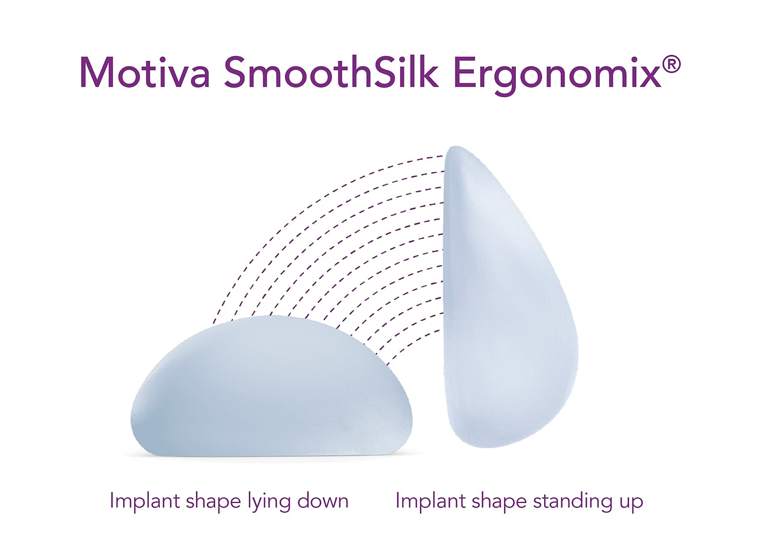Motiva SmoothSilk Ergonomix breast implant shapes.