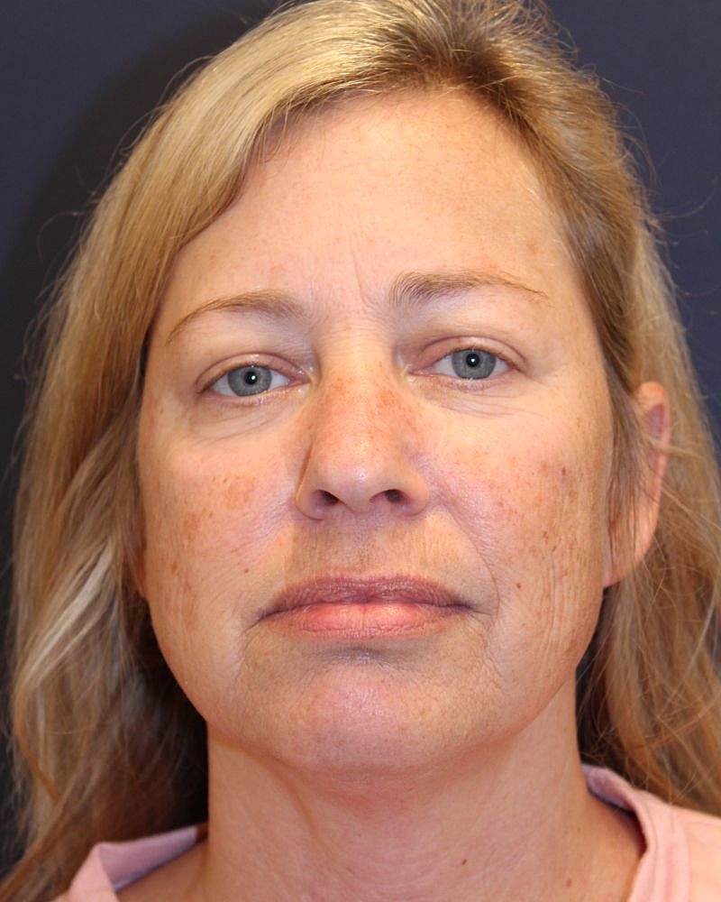 Woman with blonde hair and natural makeup.