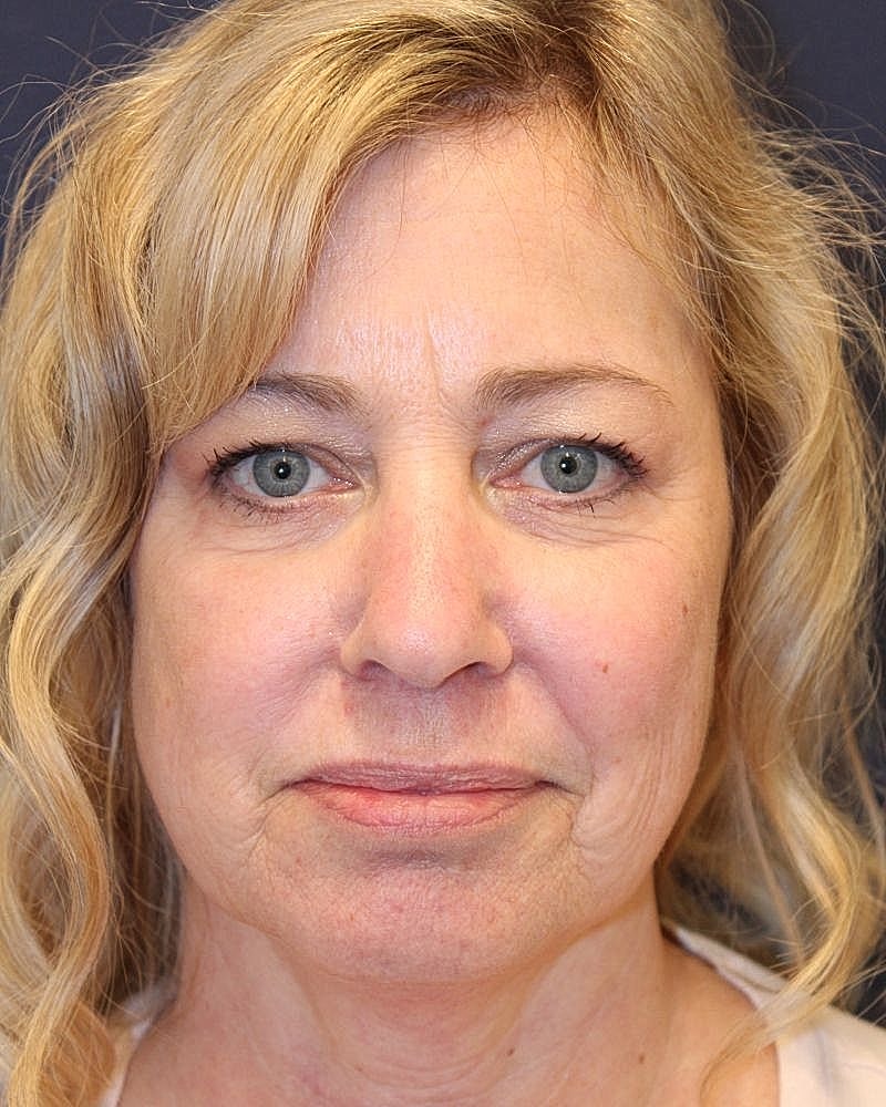 Middle-aged woman with blonde wavy hair.