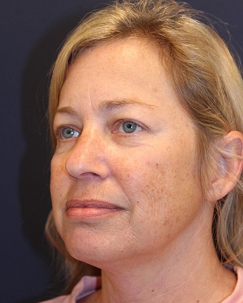 Woman with blonde hair and green eyes.