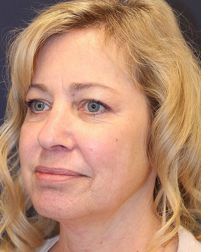 Woman with light curls and natural makeup.