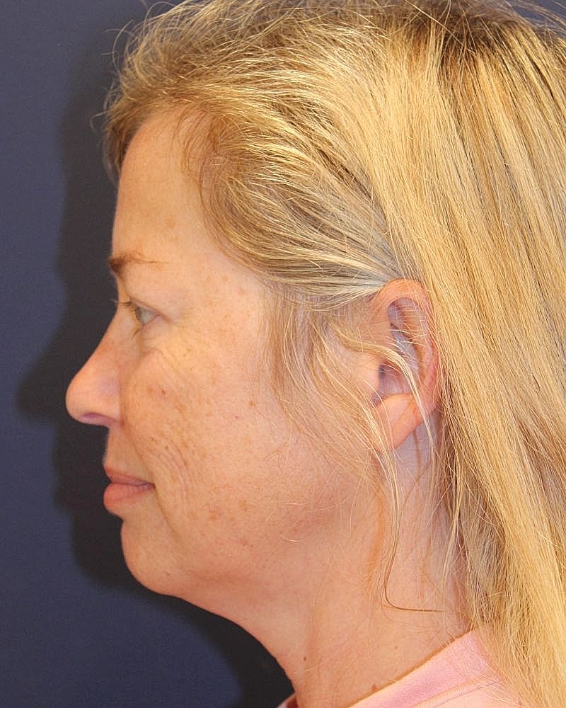 Profile view of a woman with blonde hair.