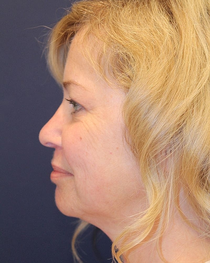 Profile view of a smiling woman with blonde hair.