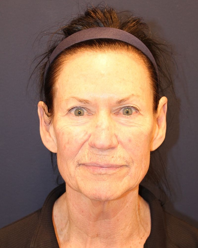 Middle-aged woman with headband and neutral expression.