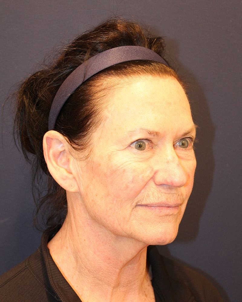 Profile view of a woman with headband.