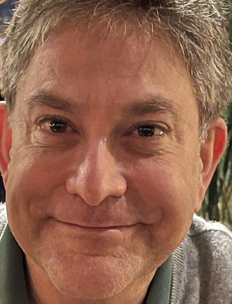 Botox Dysport Before & After