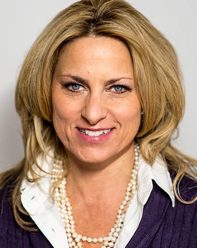 Botox Dysport Before & After