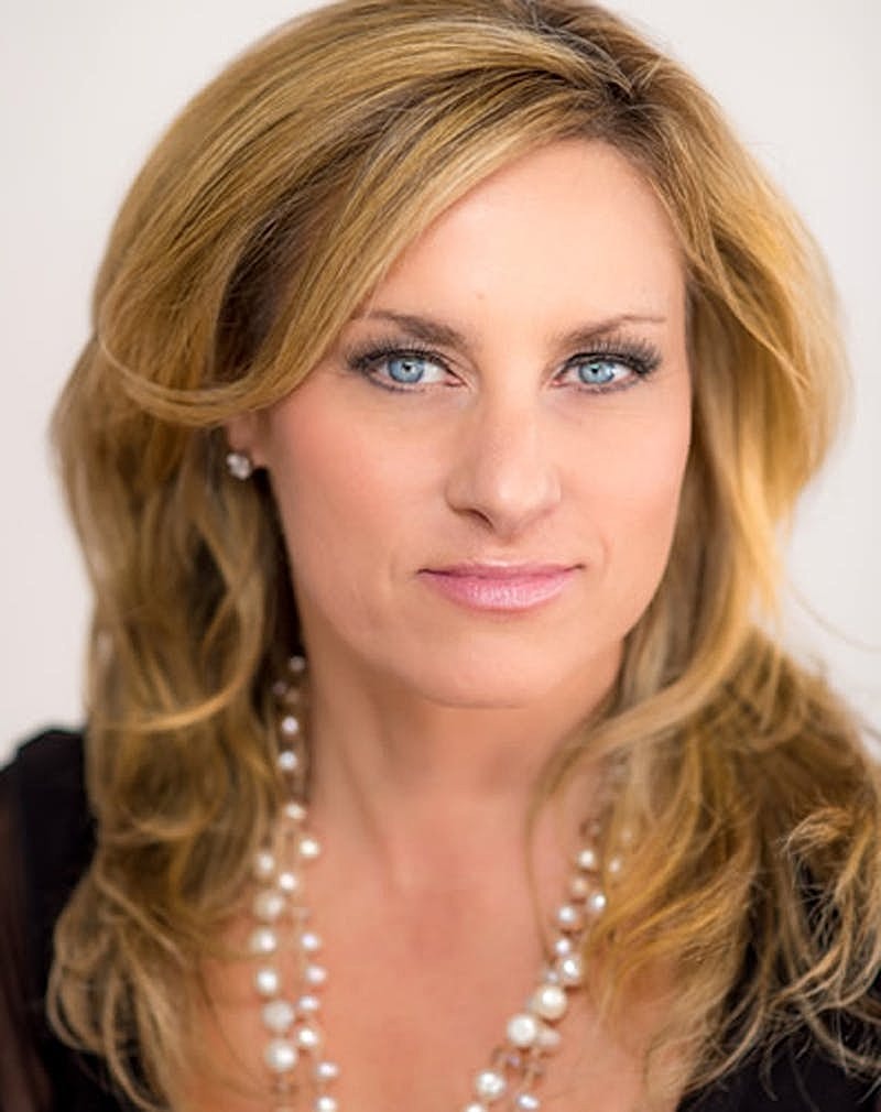 Botox Dysport Before & After