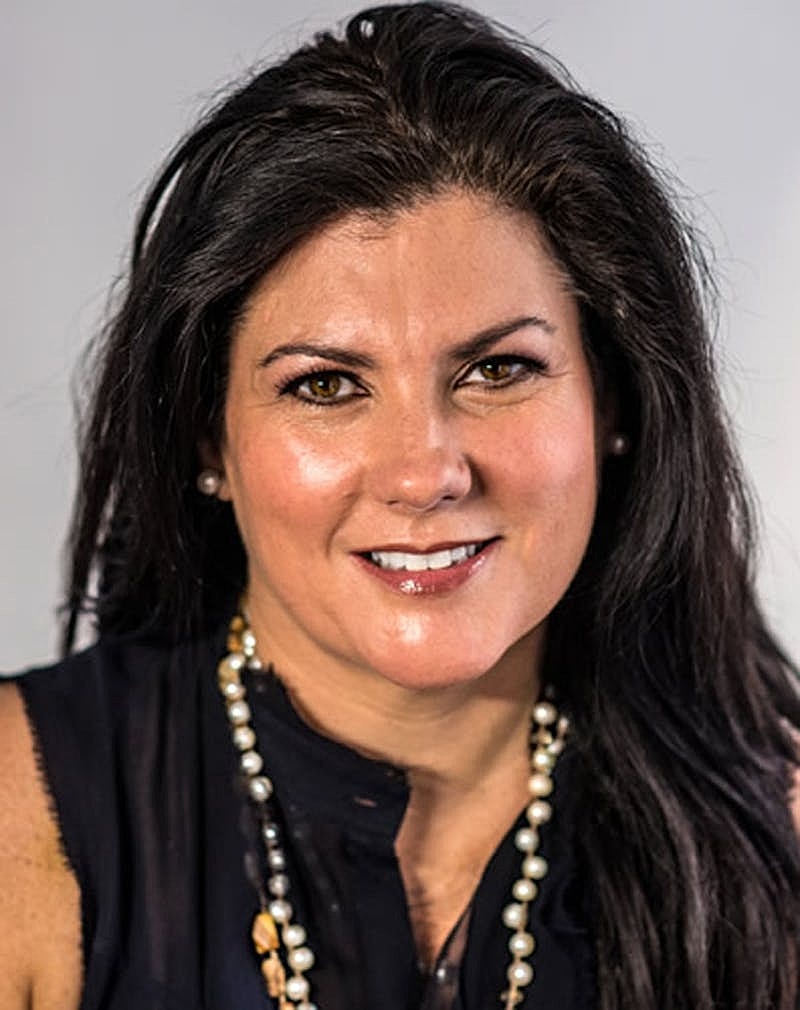 Botox Dysport Before & After