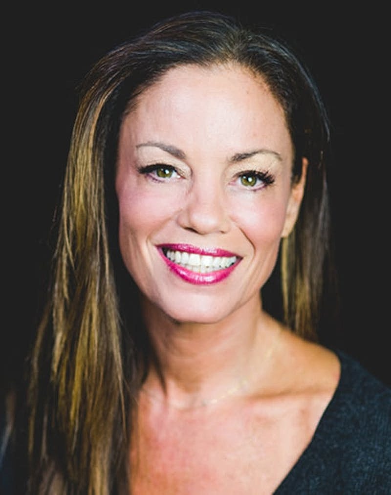 Botox Dysport Before & After