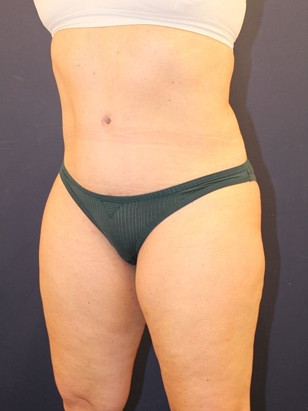 Woman in green underwear, side profile view.