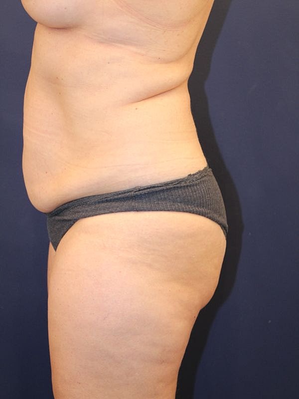 Side profile of a person's torso and hips.