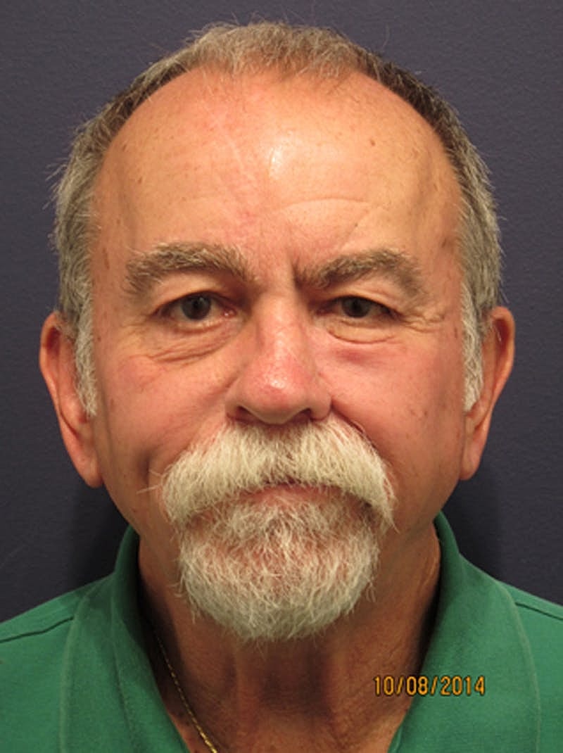 Complex Facial Reconstruction Cancer Trauma Before & After